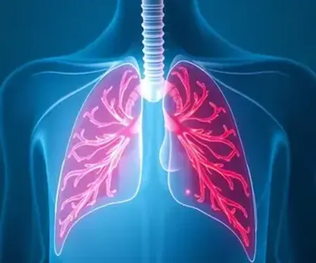 SUS passa a oferecer três novos medicamentos de alta tecnologia para o tratamento de câncer pulmonar
