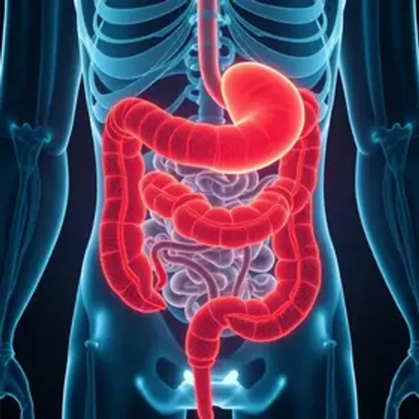 SUS tem novo protocolo para detectar câncer de intestino